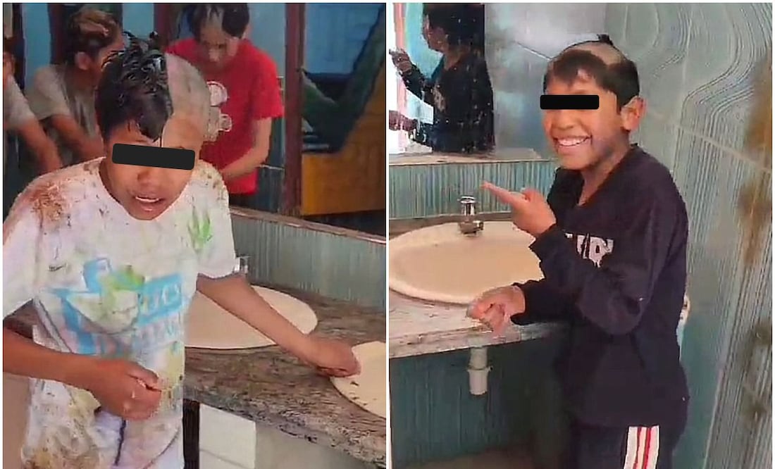 Niños se quedan sin pelo por usar crema para depilar en vez de shampoo